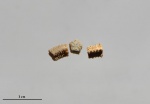 Isocrinus? neocomiensis