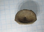 сплюснутый позвонок на определение сплюснутый позвонок на определение