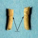Serpulidae  с аномалией?