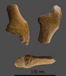 Ulna.