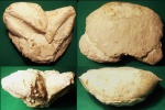 Xanthopsis