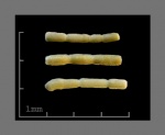 Foraminifera-11