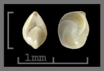 Foraminifera-26