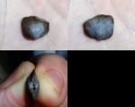 Schizophoria