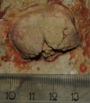 Брахиопода Clitambonitidae