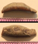 Acrodus
