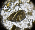 Фораминифера Astacolus sp. (?) Фораминифера Astacolus sp. (?)