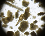 Фораминифера Spirophthalmidium sp. и загадочная иголочка