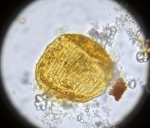 Пыльца Vittatina sp.